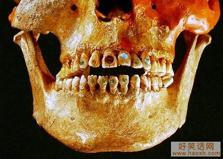 古代镶宝石牙齿
